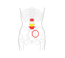 右骨盤と腰の骨１番４番