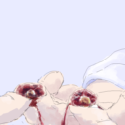 OB1198570175223.png